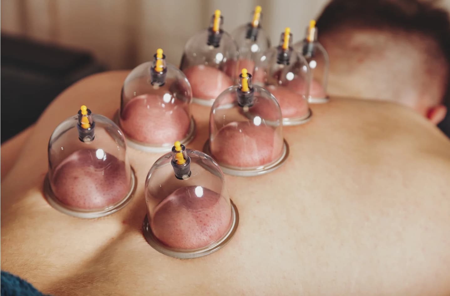 Treatment session at Therapy Jo